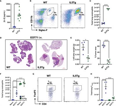 Eosinophils Decrease Pulmonary Metastatic Mammary Tumor Growth